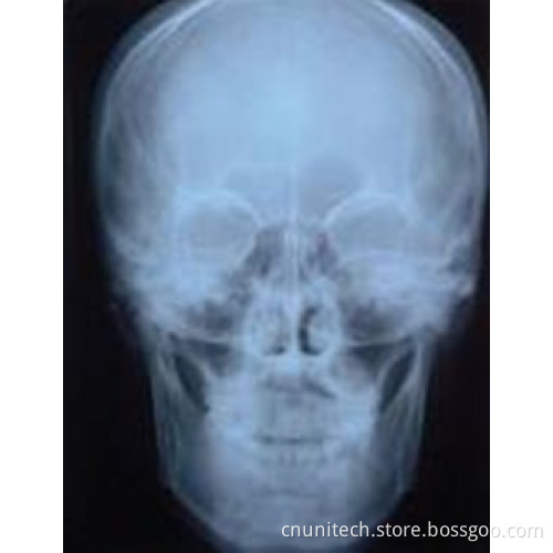 Digital Panoramic Dental X-ray Machine
